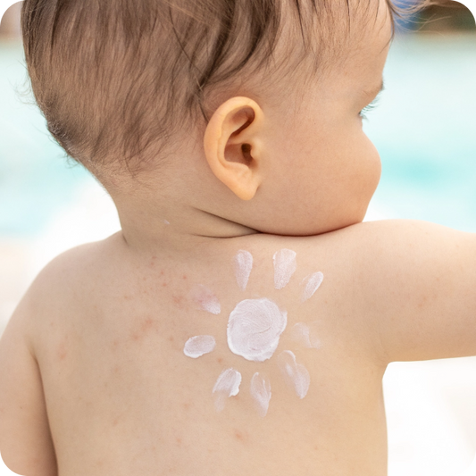 Baby mit Sonnencreme auf dem Rücken